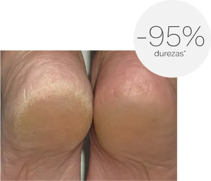 Ureadin Podos Gel Oil 75ML durezas.webp