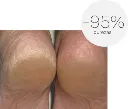 Ureadin Podos Gel Oil 75ML durezas.webp